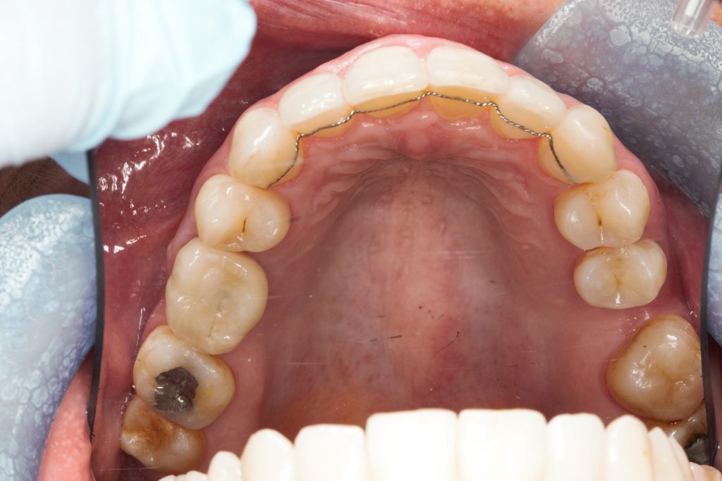 Upper Arch Private Dentistry